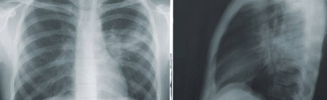 Radiologietechnologie Profil Header Bild