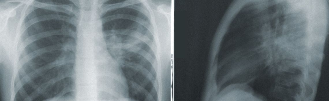 Radiologietechnologie Profil Header Bild