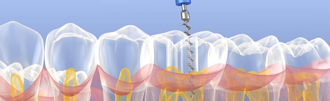 Endodontie Profil Header Bild
